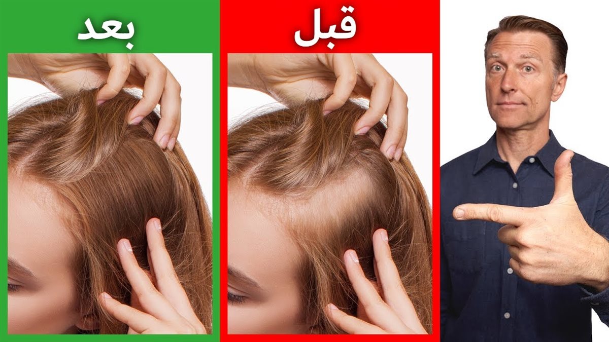 أفضل طرق تقوية الشعر الضعيف