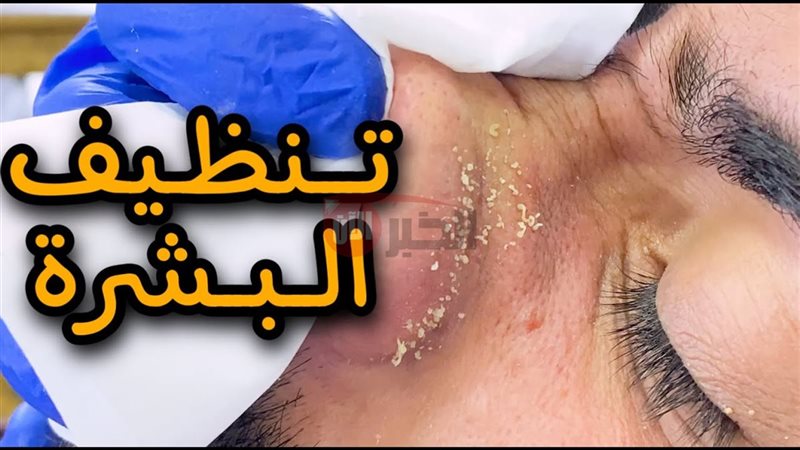 التخلص من البشرة