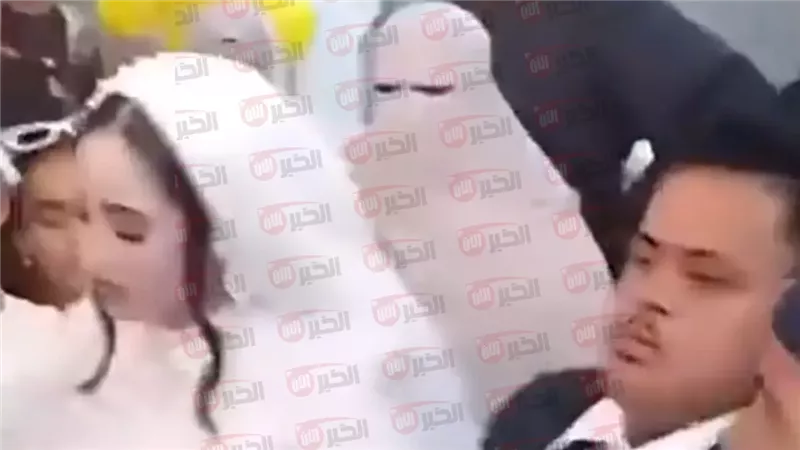 حكم زواج متلازمة