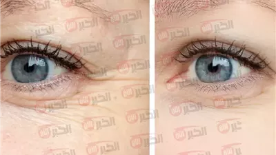 ماسك لشد الوجه وإزالة التجاعيد في 10 دقائق بمكونات طبيعية بديلة للعمليات