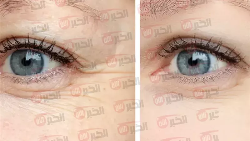 ماسك لشد الوجه 