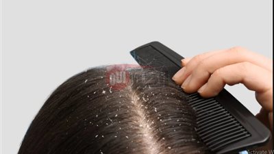 افضل وصفات طبيعية لترطيب فروة الرأس بعمق والتخلص من الجفاف