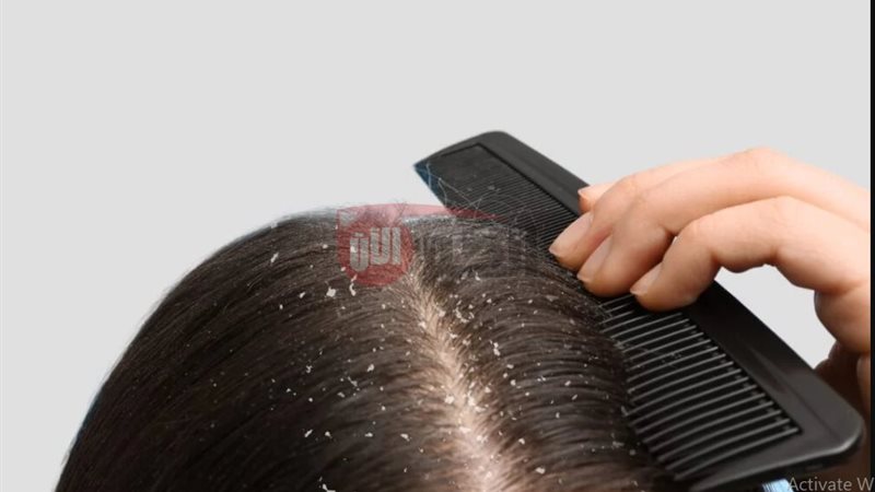 وصفات طبيعية لترطيب