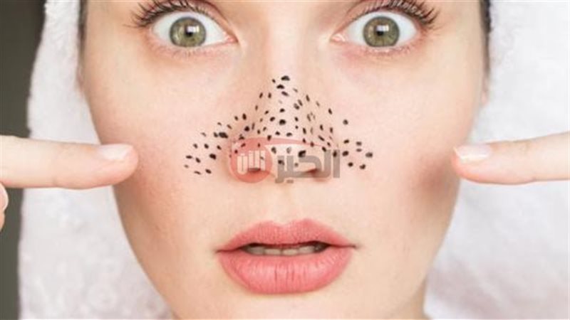 ماسكات طبيعية لإزالة